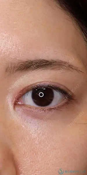 6 days after image