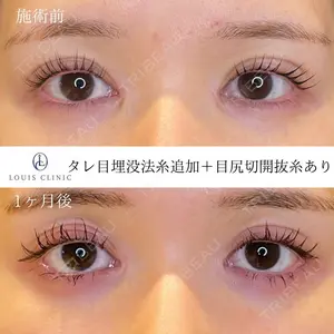 30 days after image