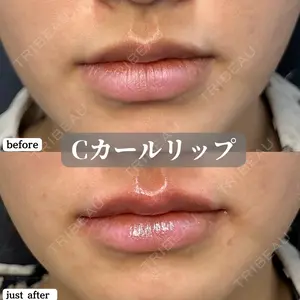 before image
