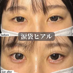 before image
