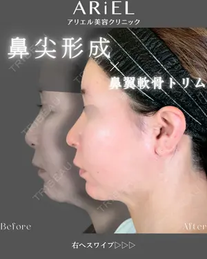 90 days after image