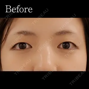 before image