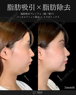 30 days after image