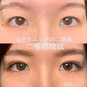 30 days after image