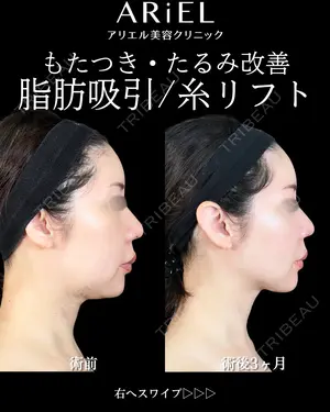 90 days after image