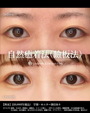 before image