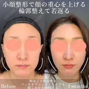 90 days after image