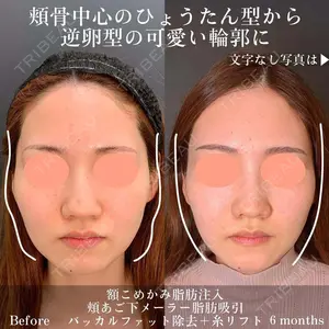 180 days after image