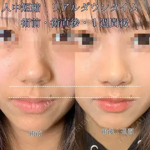 7 days after image