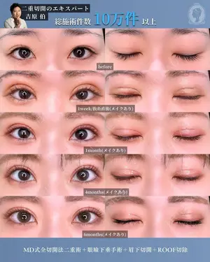 180 days after image