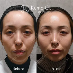 90 days after image