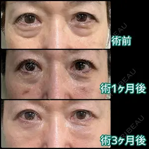 120 days after image