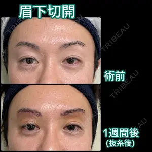 7 days after image