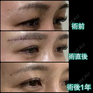 365 days after image