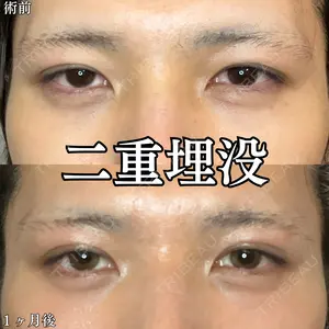 30 days after image