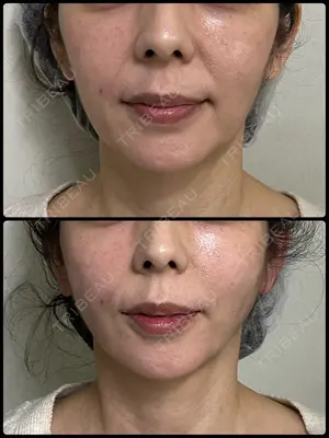 7 days after image