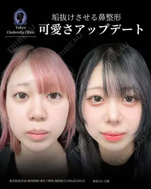 90 days after image