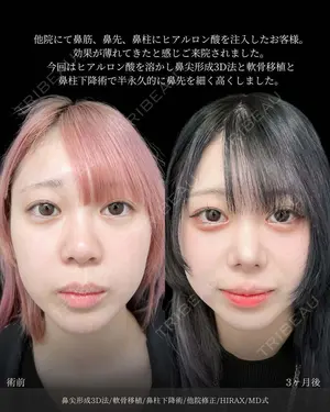 before image
