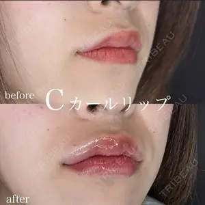 before image