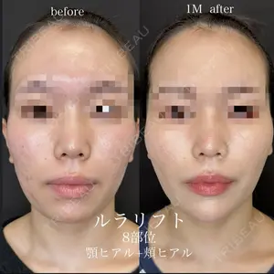 before image