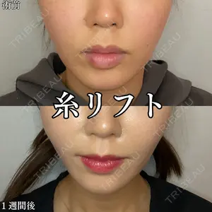 7 days after image