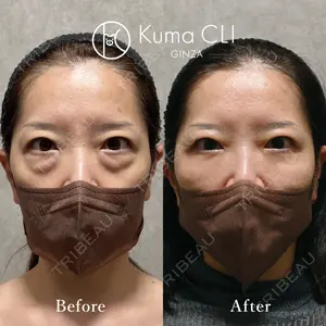 90 days after image