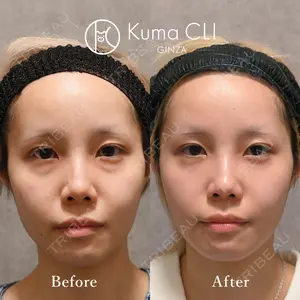 90 days after image