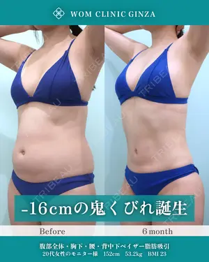180 days after image