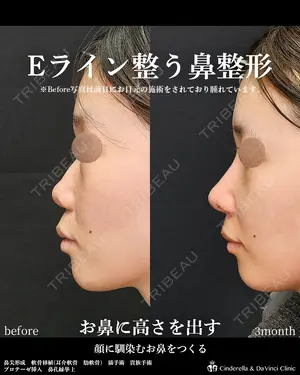 90 days after image