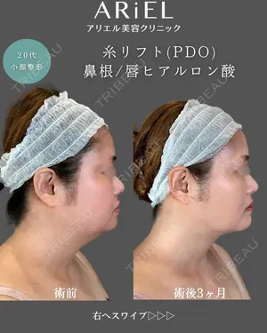 before image