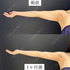 null days after image
