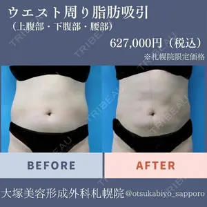 0 days after image