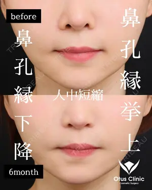 180 days after image