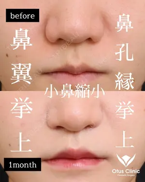 30 days after image