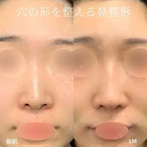 null days after image
