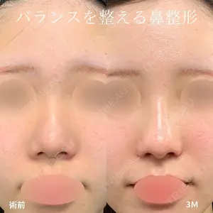 null days after image