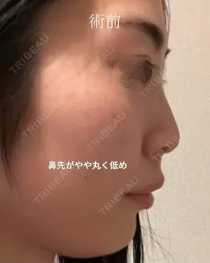 before image