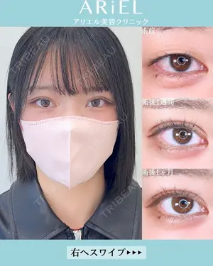 30 days after image
