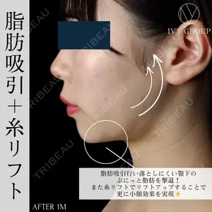30 days after image