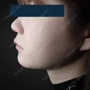 30 days after image
