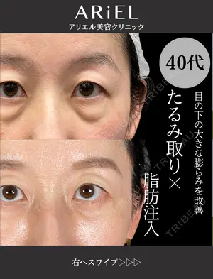 90 days after image