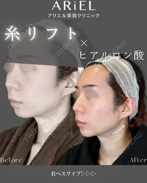 30 days after image