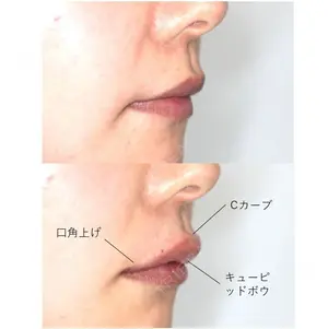 before image