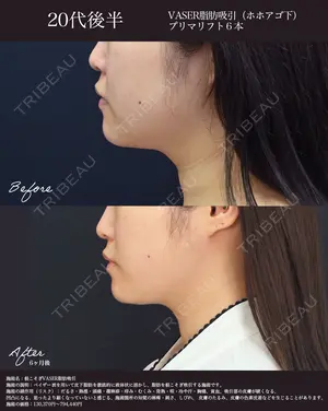 180 days after image