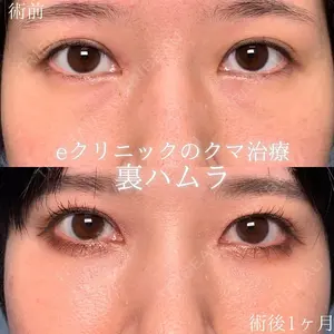 30 days after image