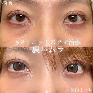before image