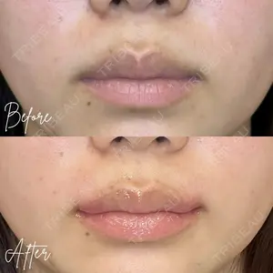0 days after image