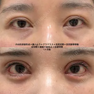 40 days after image