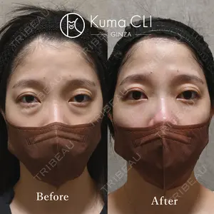 90 days after image