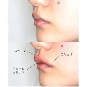 before image
